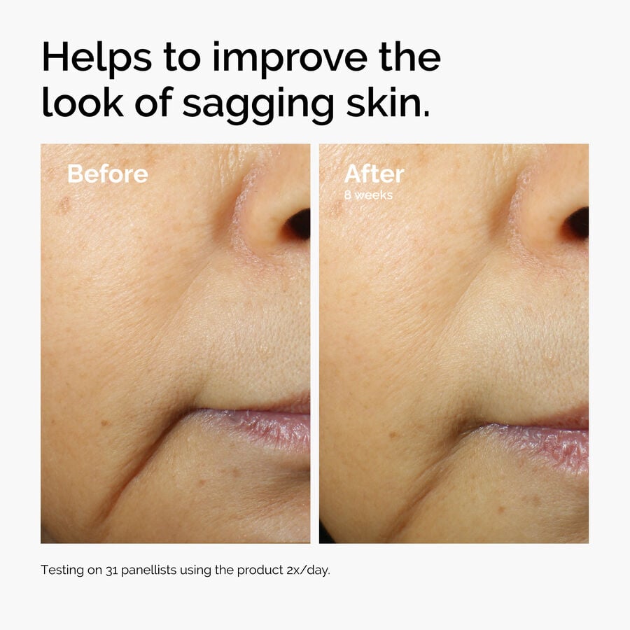 caffeine-3-escin-1-face-serum-m8 ord-caffeine-3pct-escin-1pct-face-serum-before-after-sagging.jpg