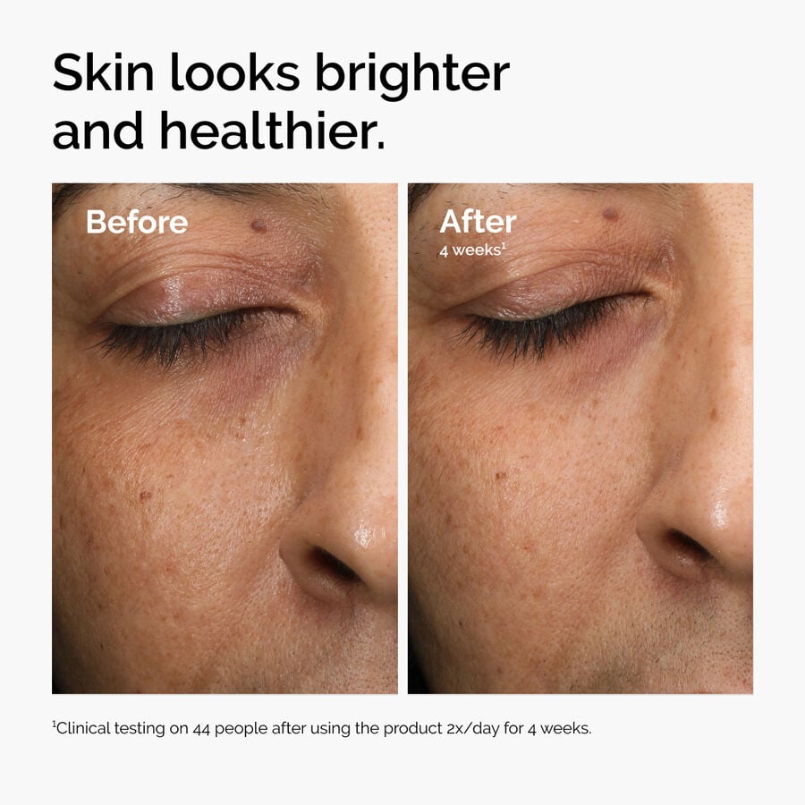 multi-antioxidant-radiance-serum-x3 ord-mars-before-after-healthy.jpg