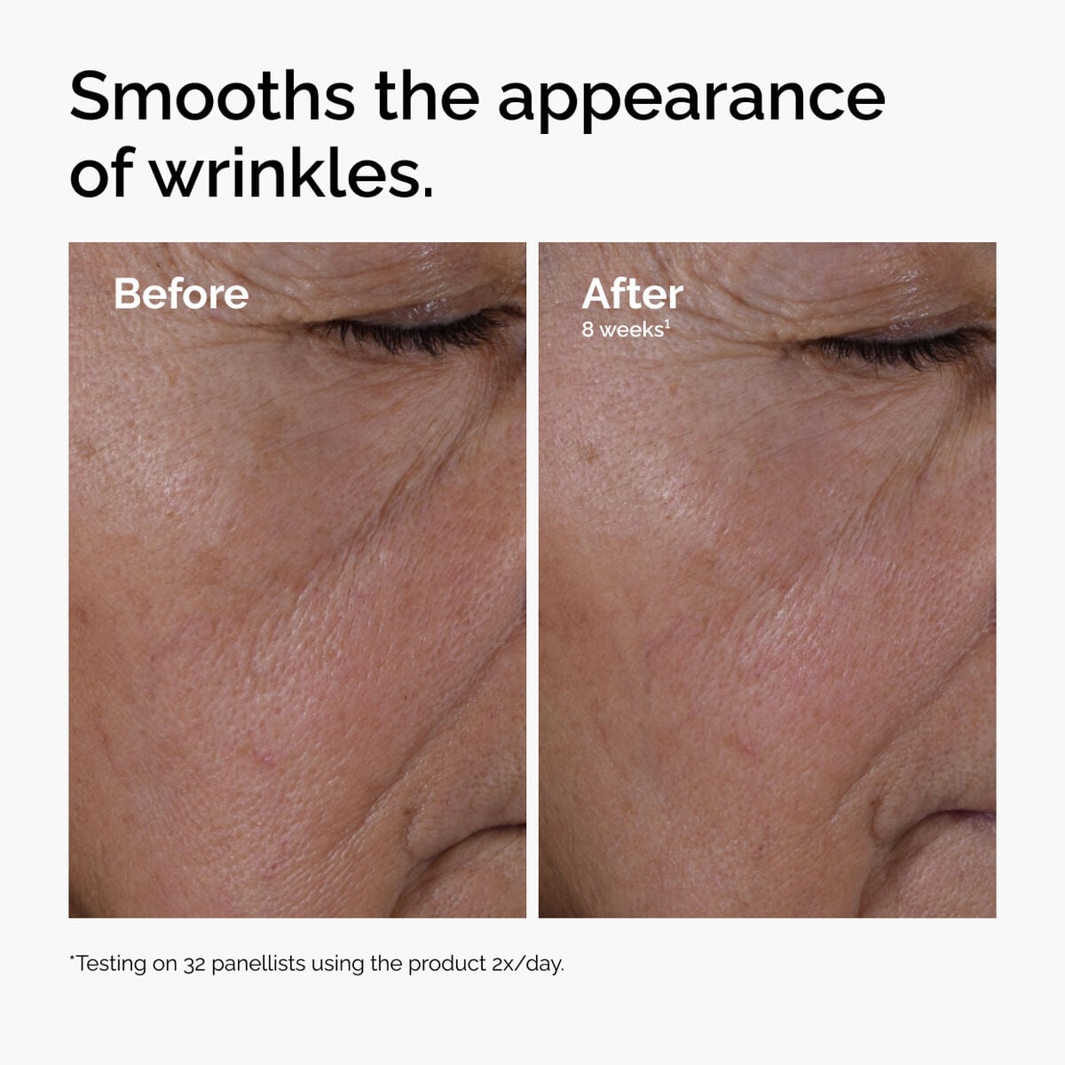 multi-peptide-ha-serum-x9 ord-multi-peptide-ha-serum-wrinkles-before-after.jpg
