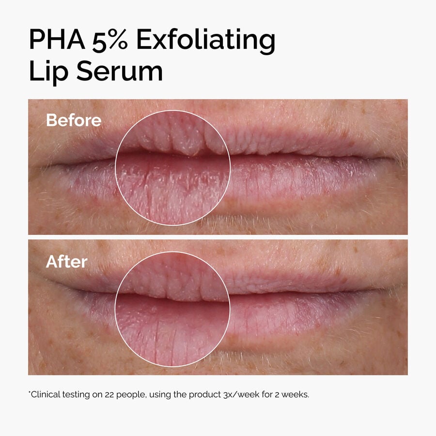pha-5-exfoliating-lip-serum-n8 ord-pha-5pct-lip-exfoliating-serum-before-after.jpg