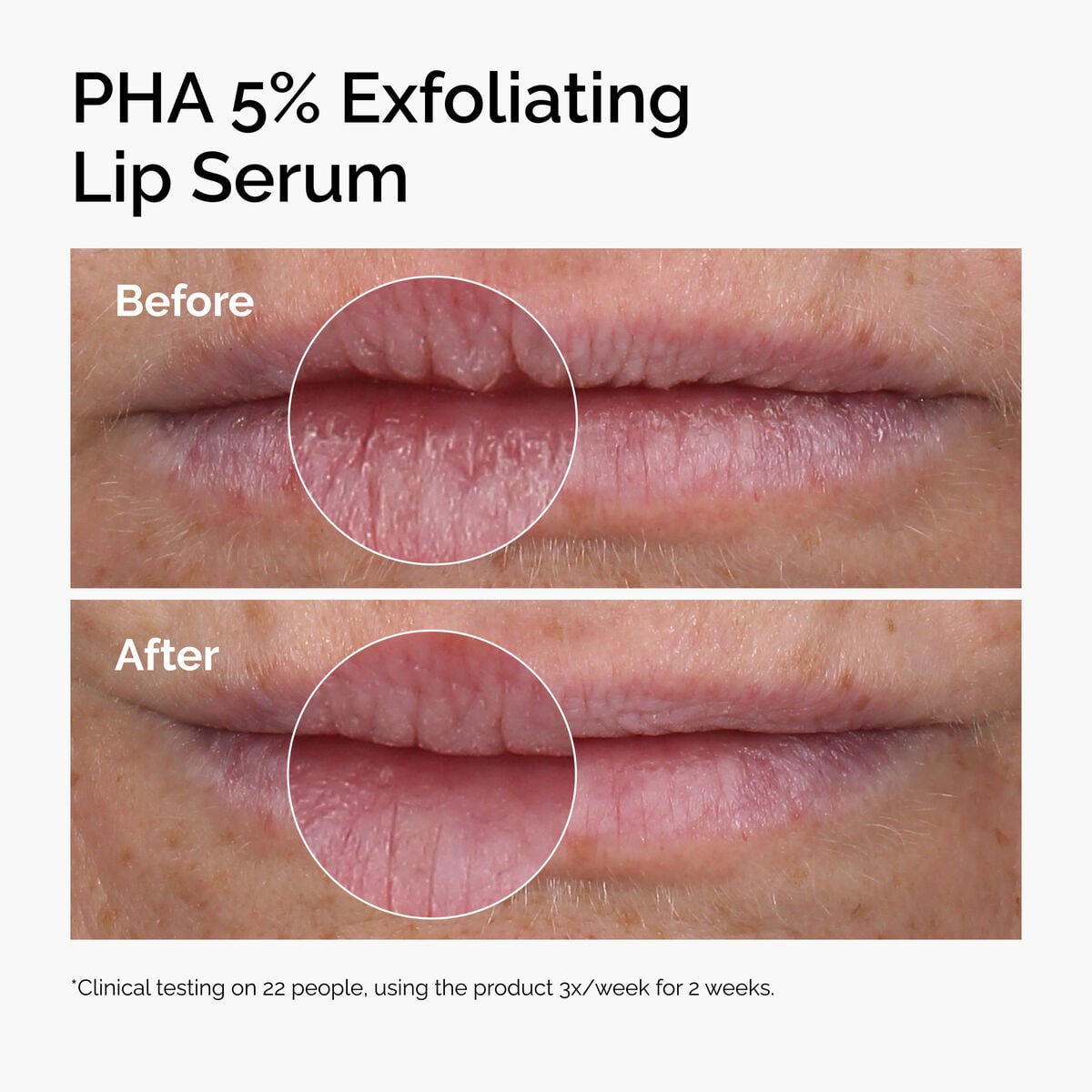 pha-5-exfoliating-lip-serum-o5 ord-pha-5pct-lip-exfoliating-serum-before-after.jpg