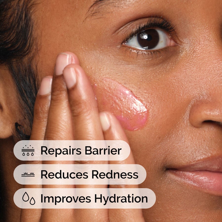 soothing-and-barrier-support-serum-set-x0 ord-soothing-barrier-support-serum-model-application-with-benefits.jpg
