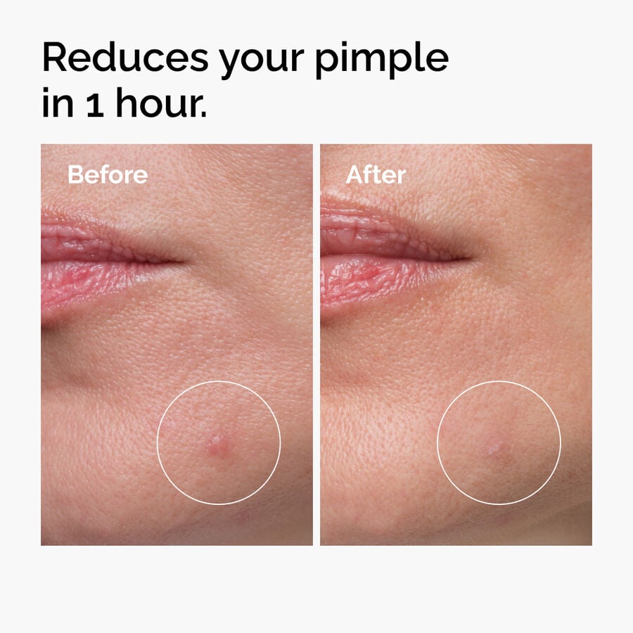 sulfur-10-powder-to-cream-concentrate-y1 ord-sulfur-10pct-powder-to-cream-concentrate-before-after-NA.jpg