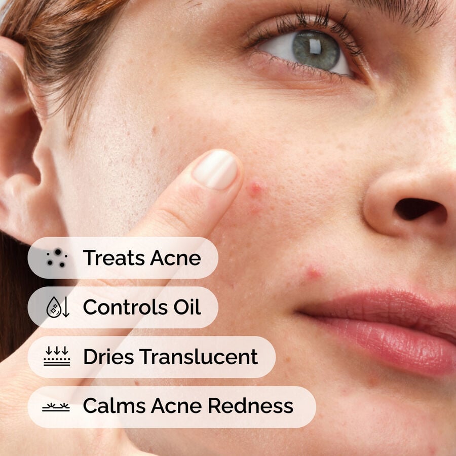 sulfur-10-powder-to-cream-concentrate-y1 ord-sulfur-10pct-powder-to-cream-concentrate-model-application-with-benefits-acne.jpg
